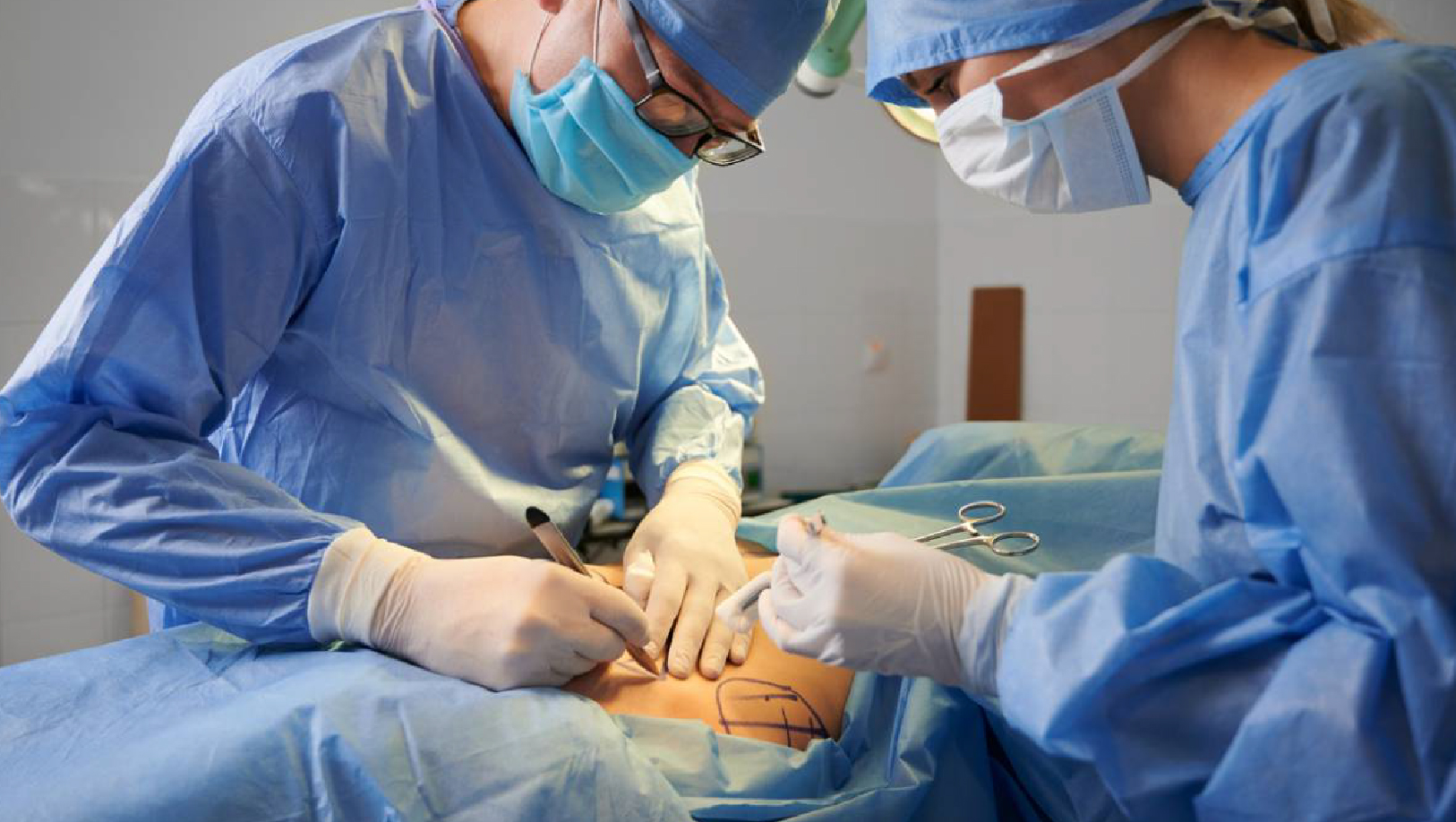 Body sculpting and body remodeling treatment
