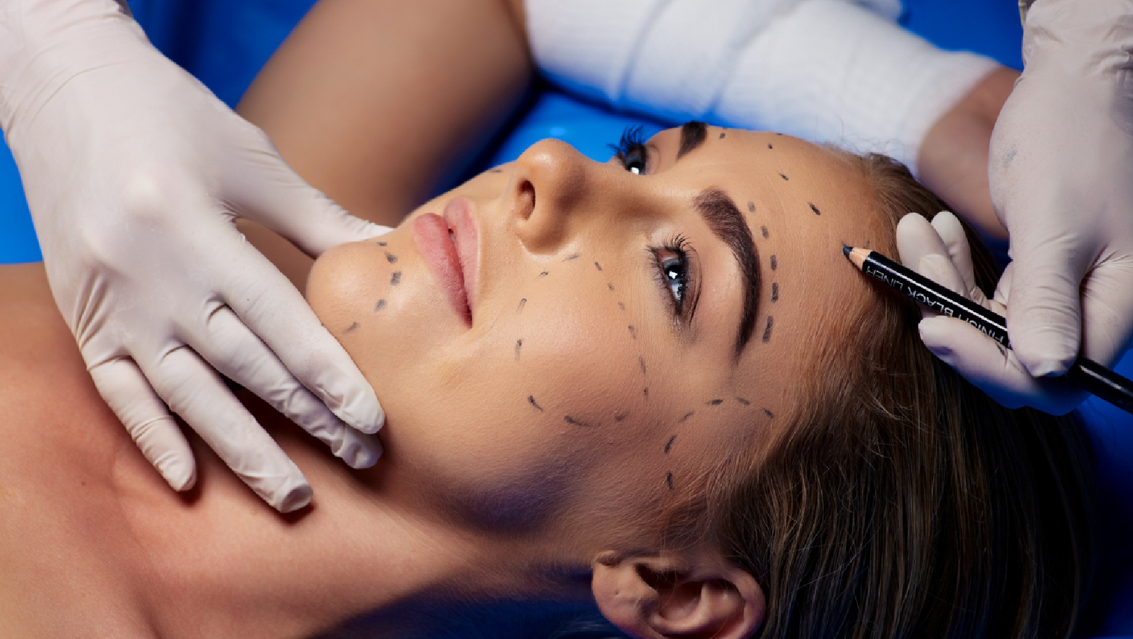 Non-surgical aesthetic medicine treatment