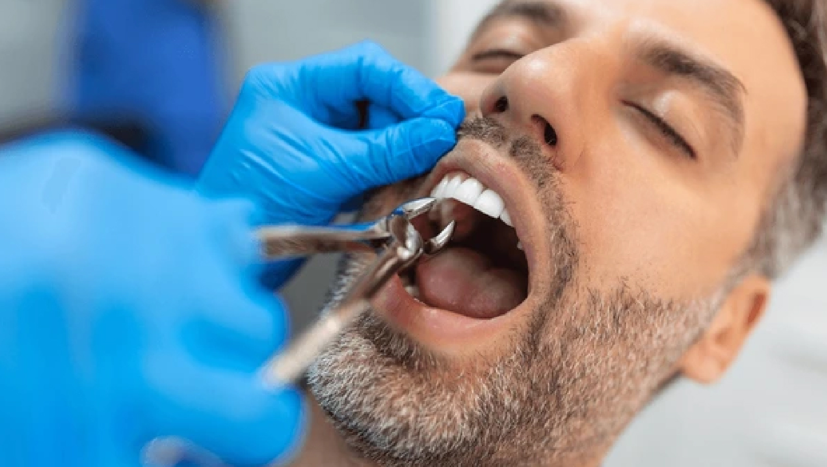 Aesthetic dental smile transformation