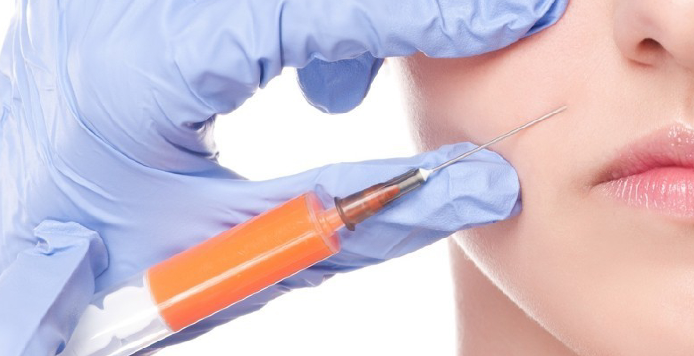 Lipofilling (Fat Transfer)