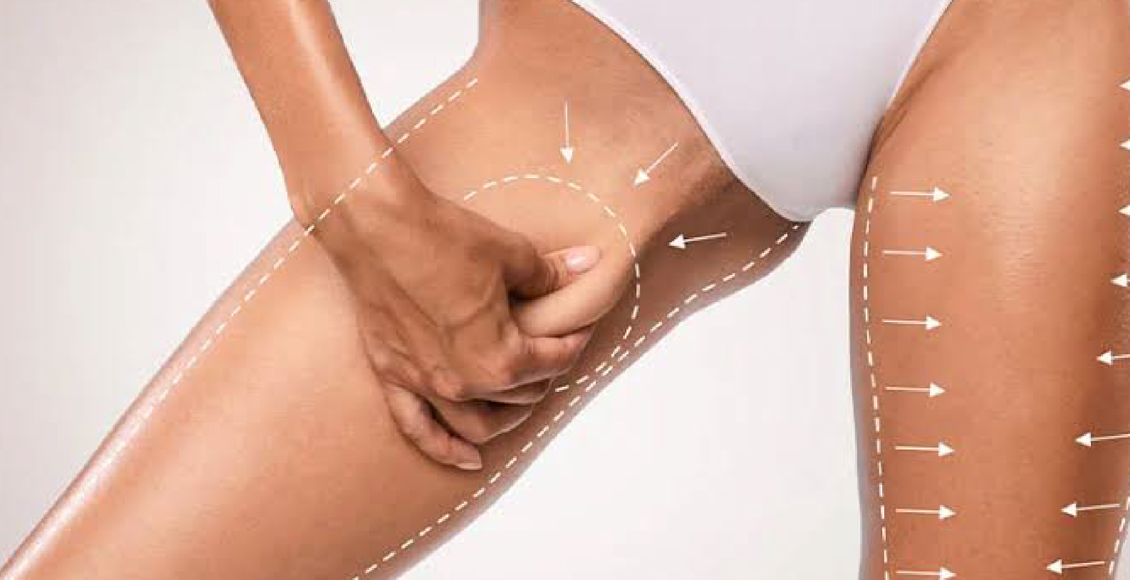 Thigh Lift