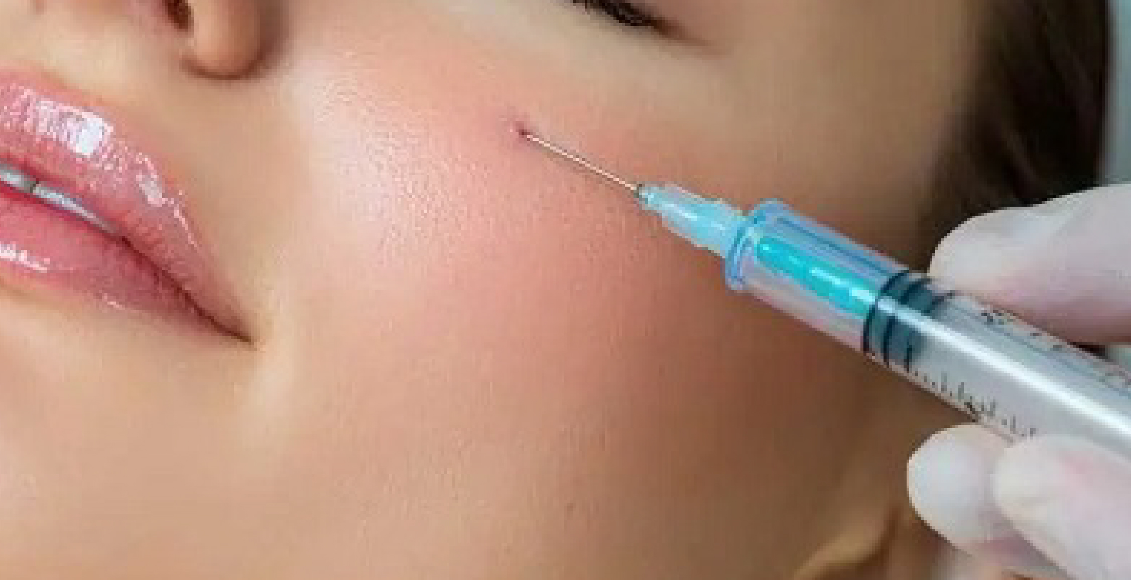 Botox