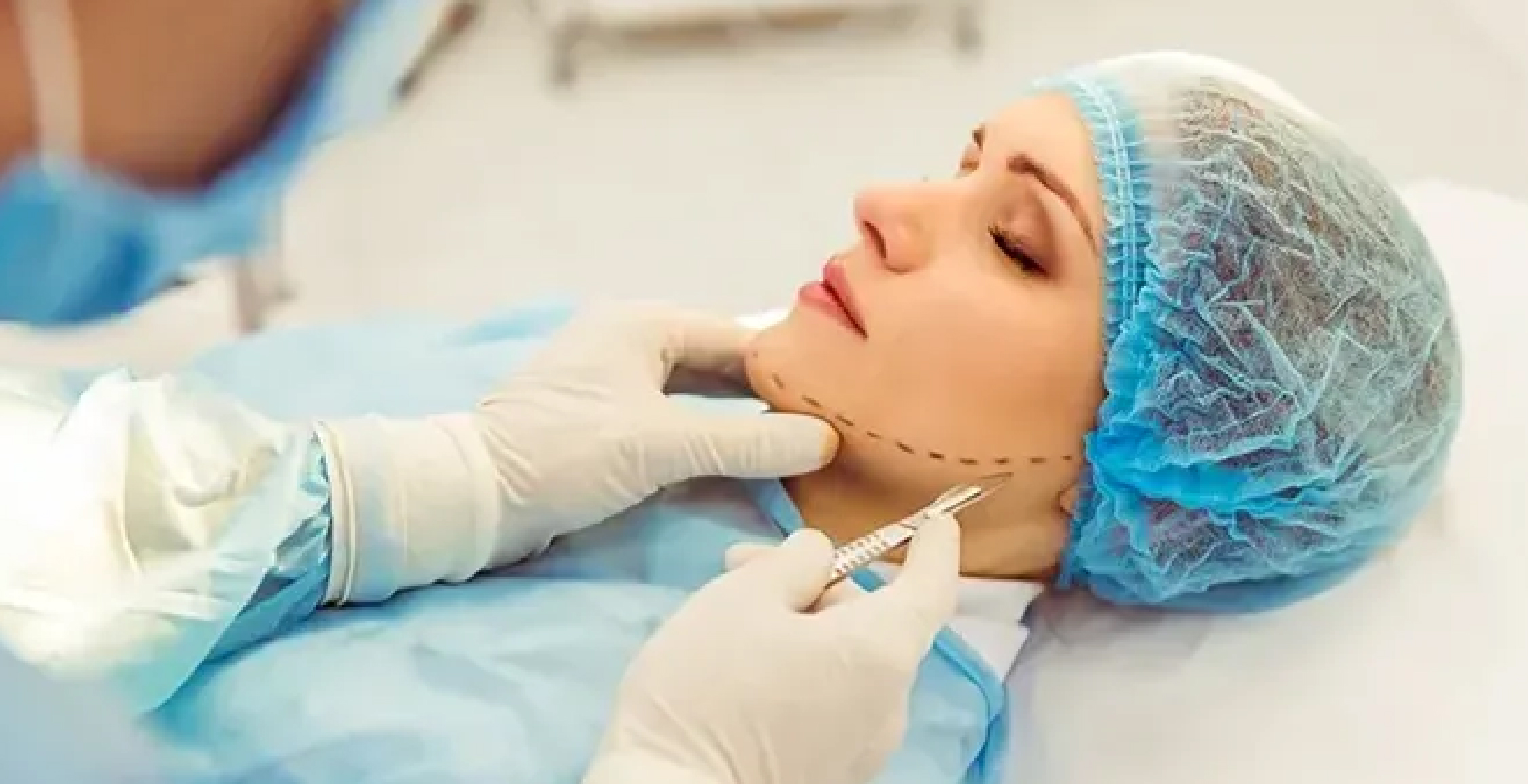 Neck Lift