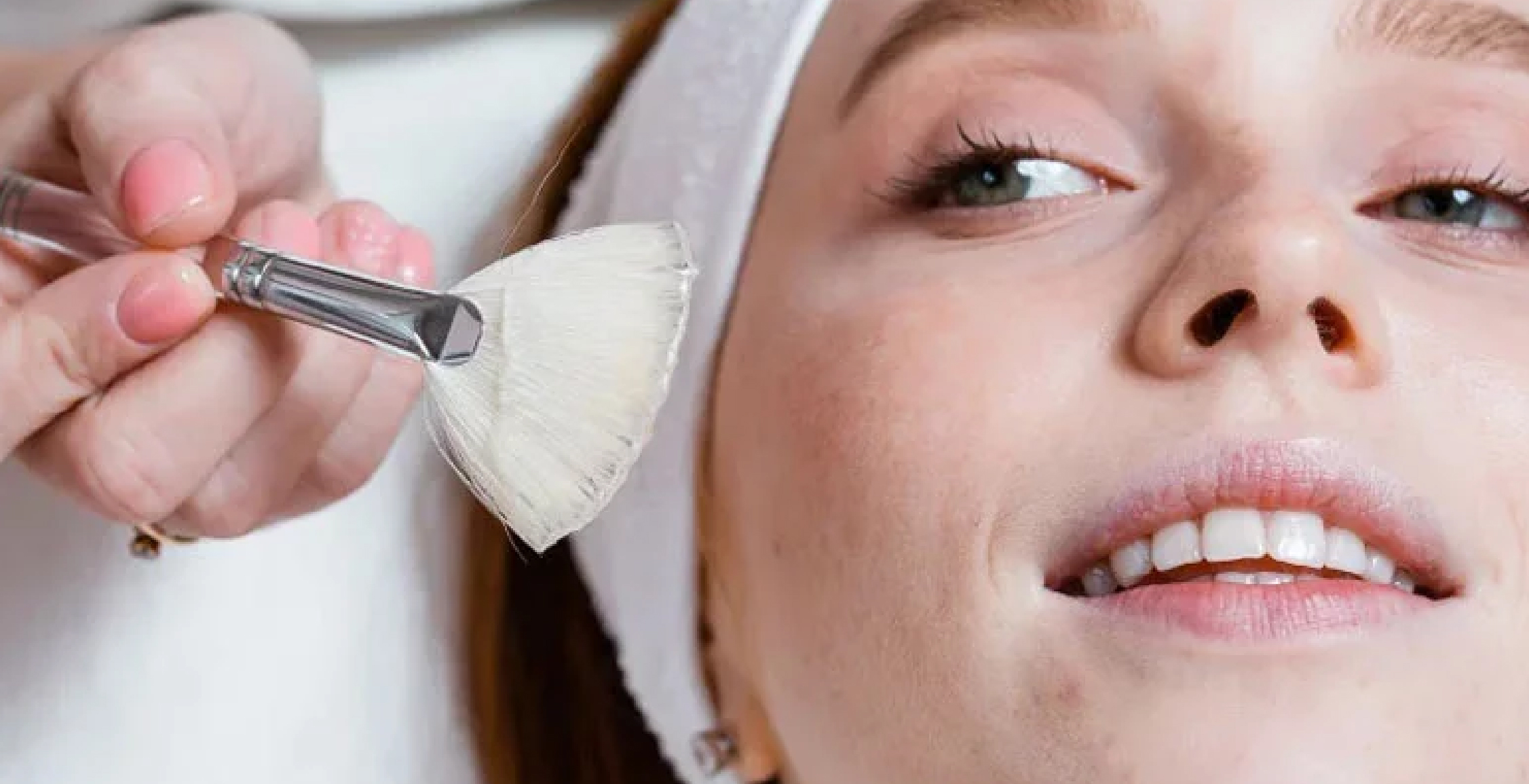 Chemical Peels