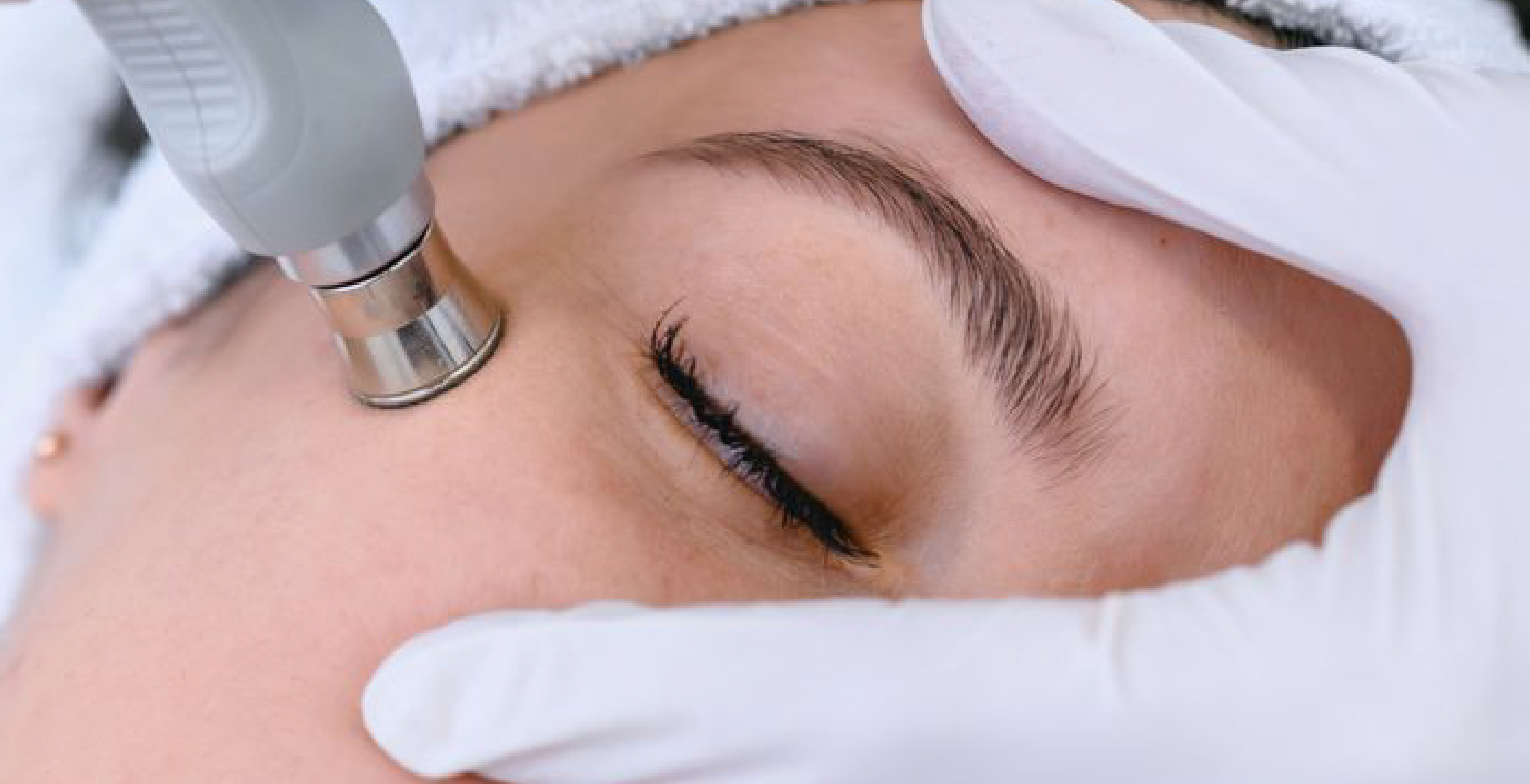 Aesthetic Laser