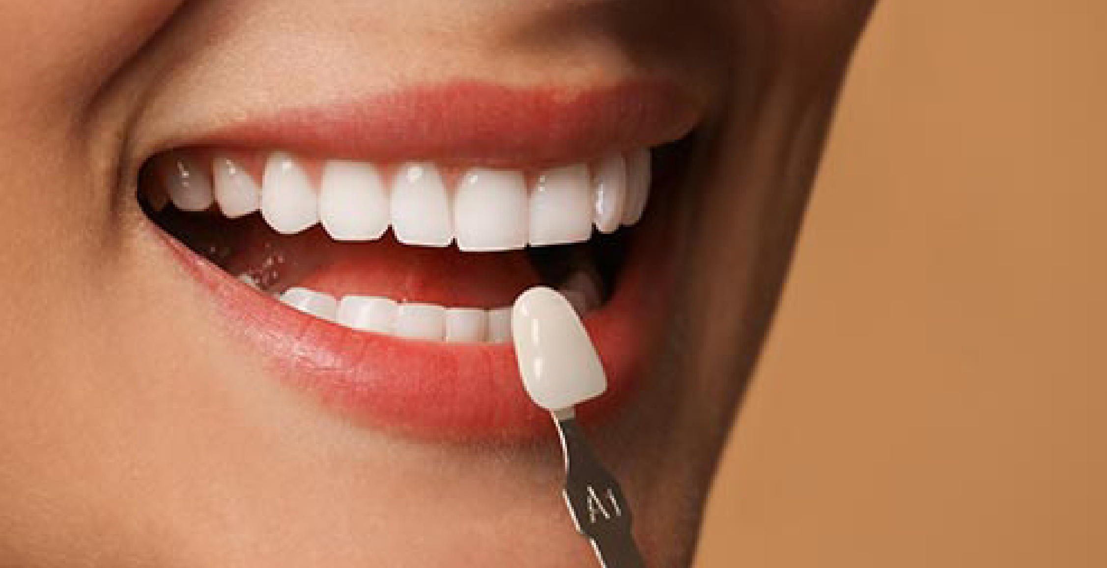 Hollywood Smile