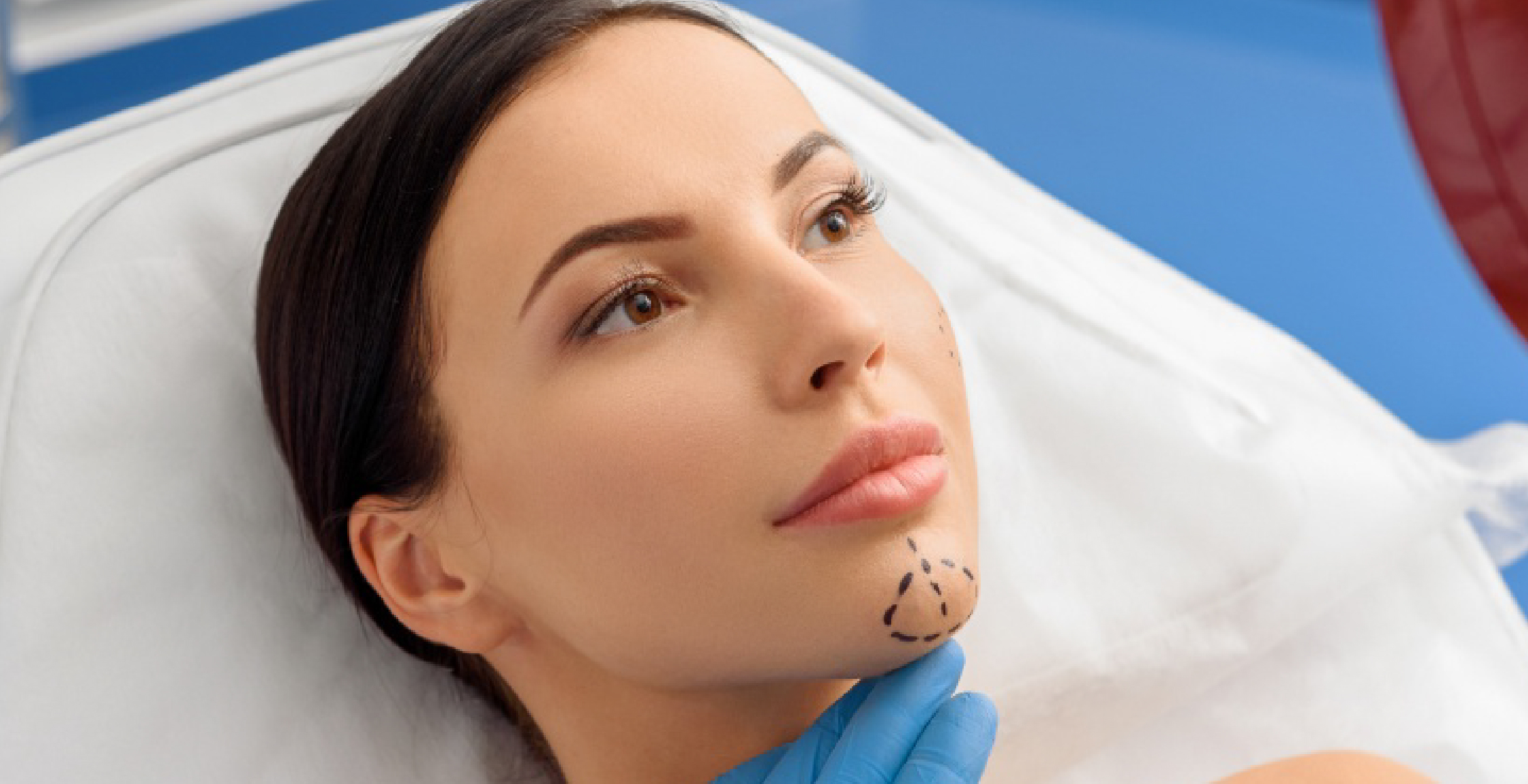 Genioplasty (Chin)
