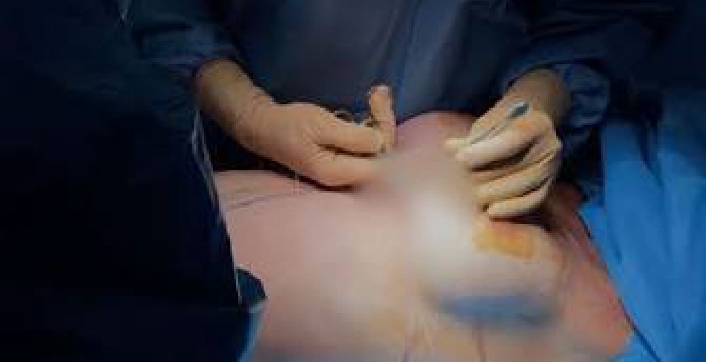 Breast Reduction