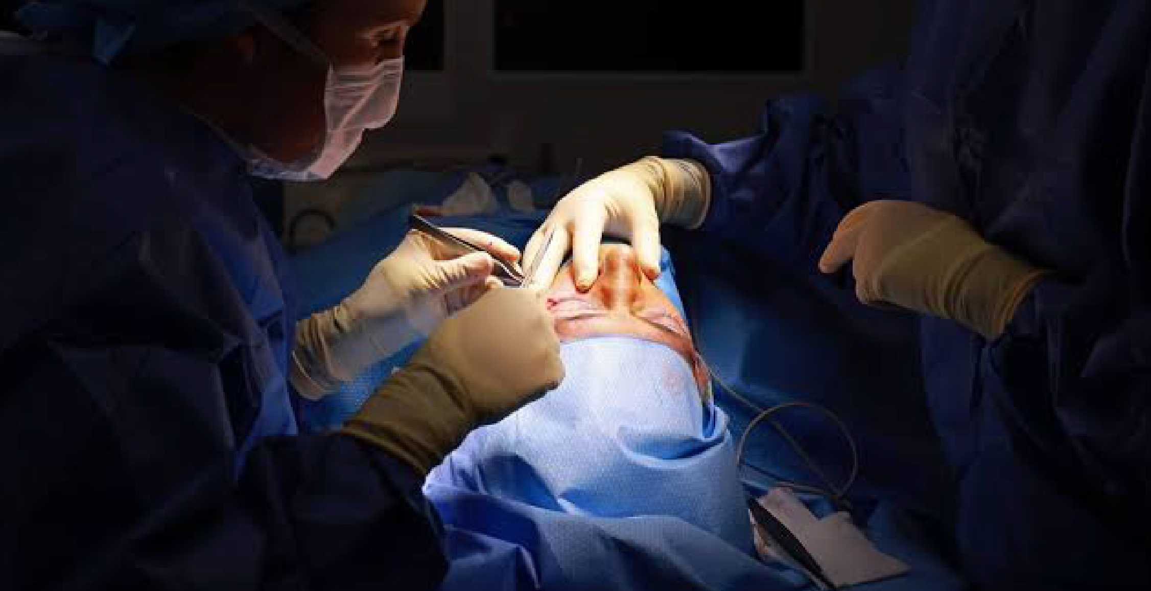 Rhinoplasty (Nose Surgery)